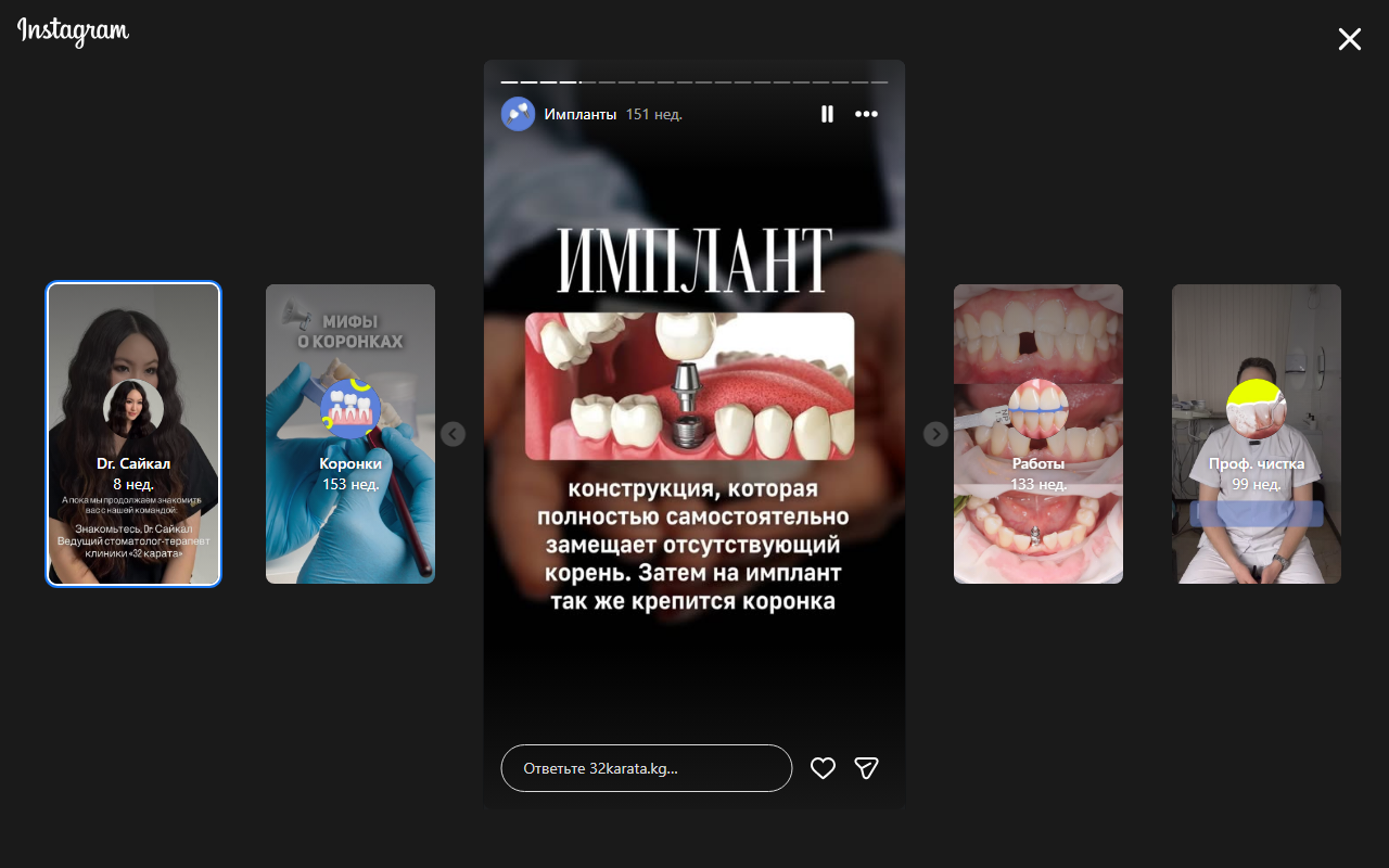Схема импланта — 3D модель