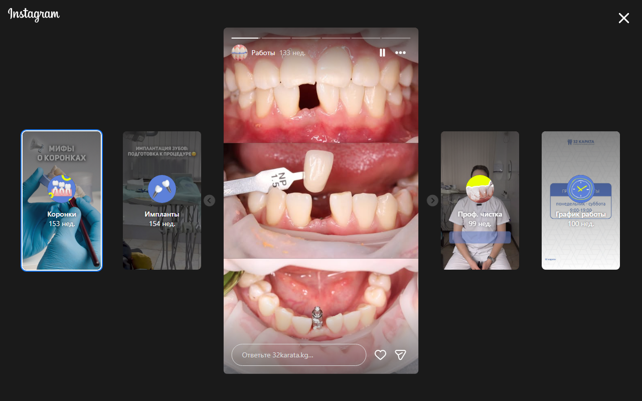 Кейс до и после — стоматологические работы