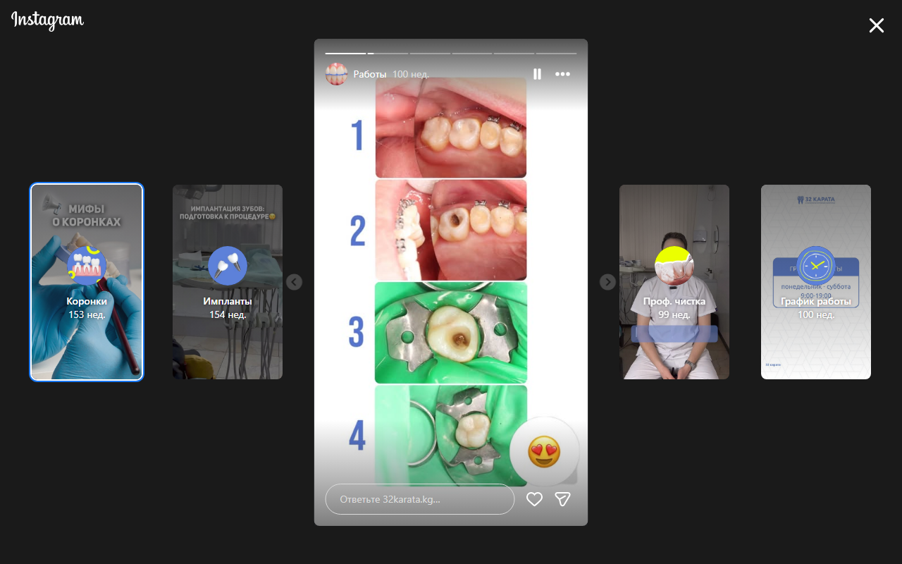 4 фото процесса — до, подготовка, лечение, после