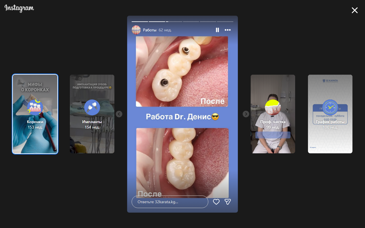 Работа Dr. Дениса — коронки и эстетика