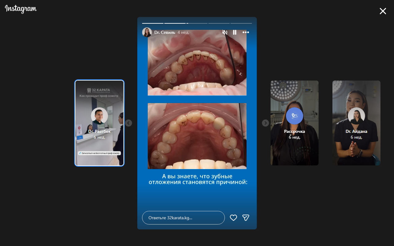 Dr. Севиль — кейс до/после профчистки