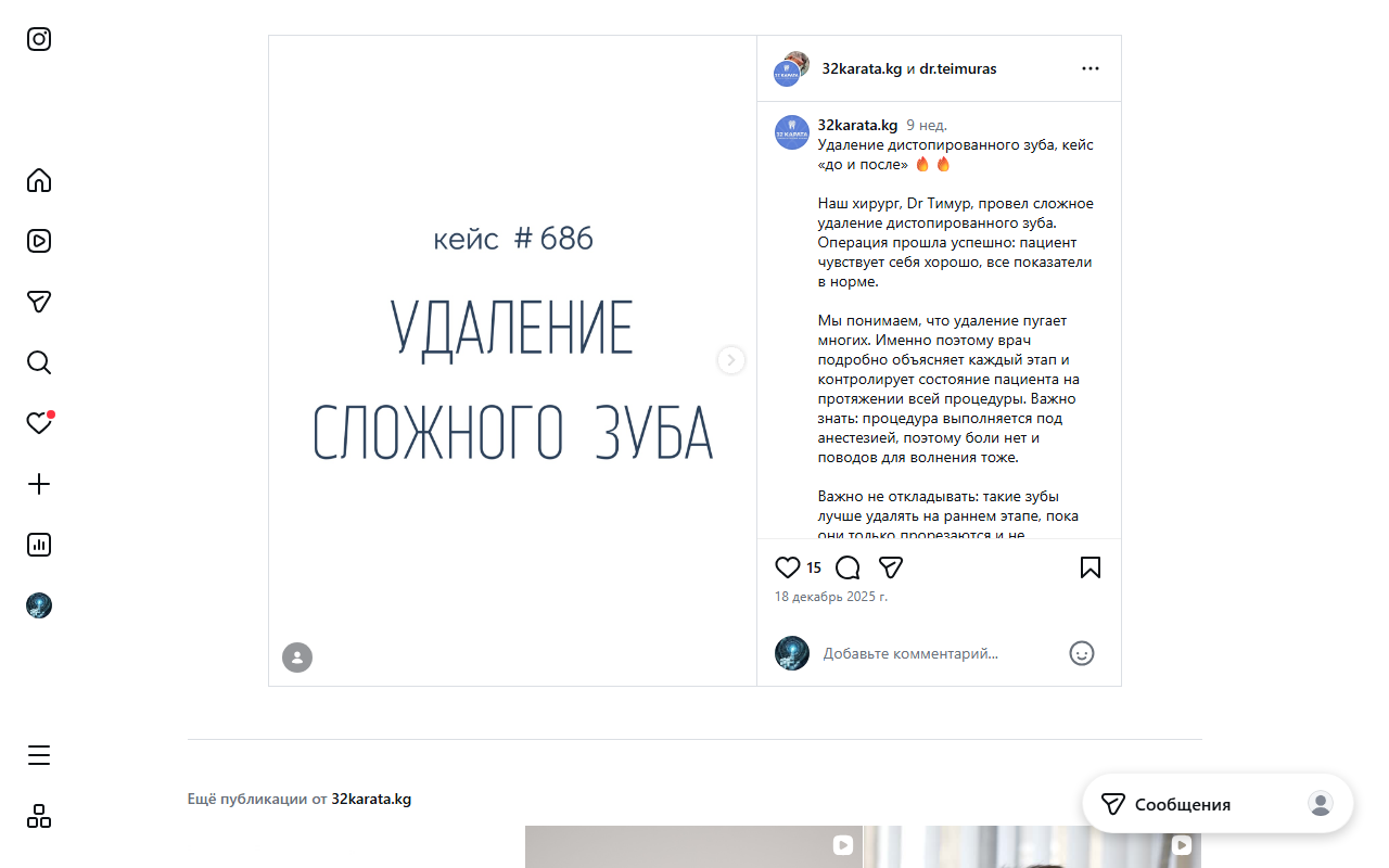 Кейс #686 — удаление сложного зуба