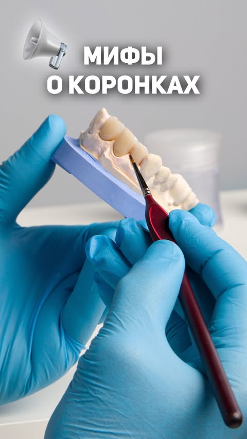 Профессиональная чистка зубов