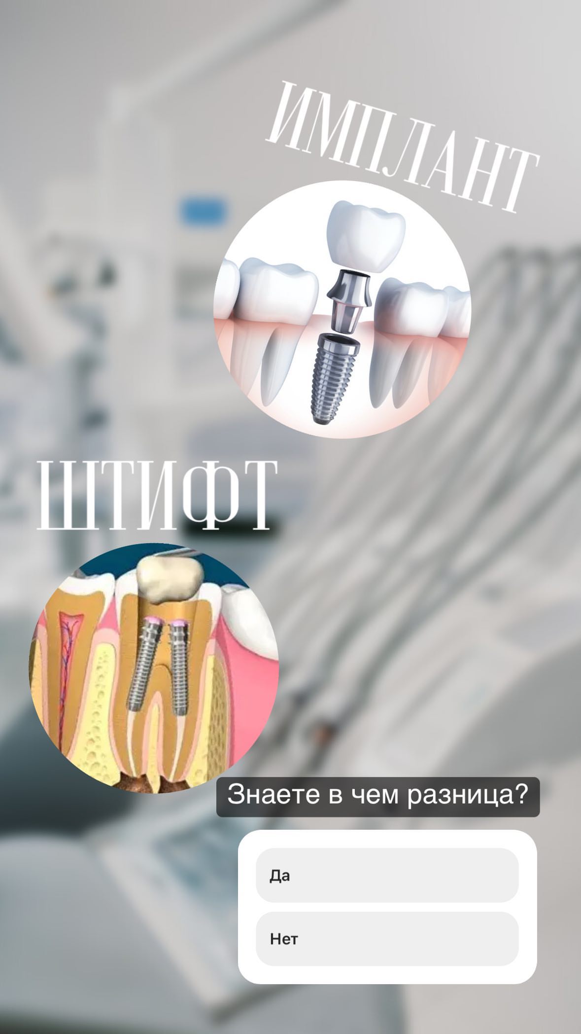Имплантация — работа 3