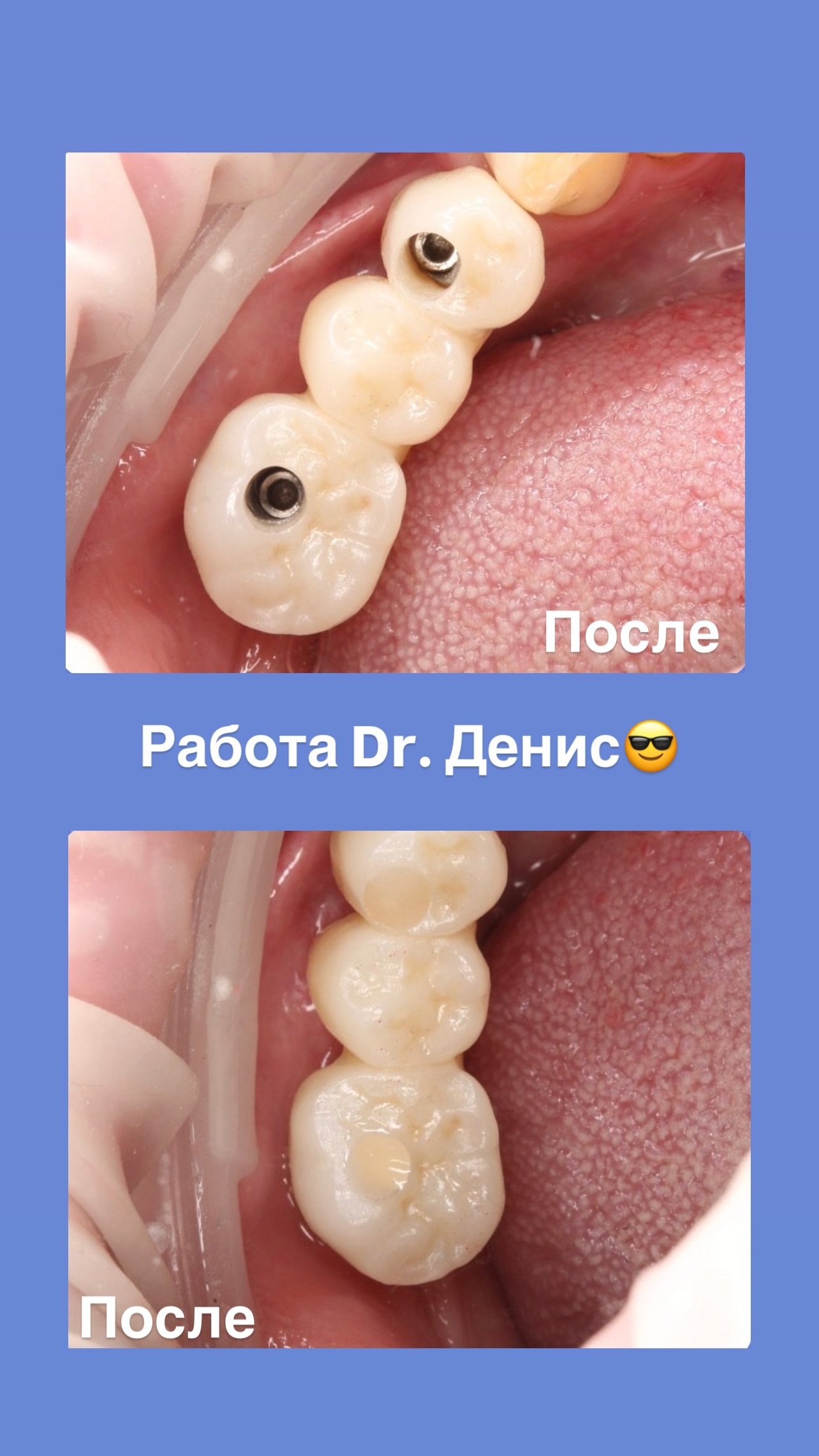 Работа 4