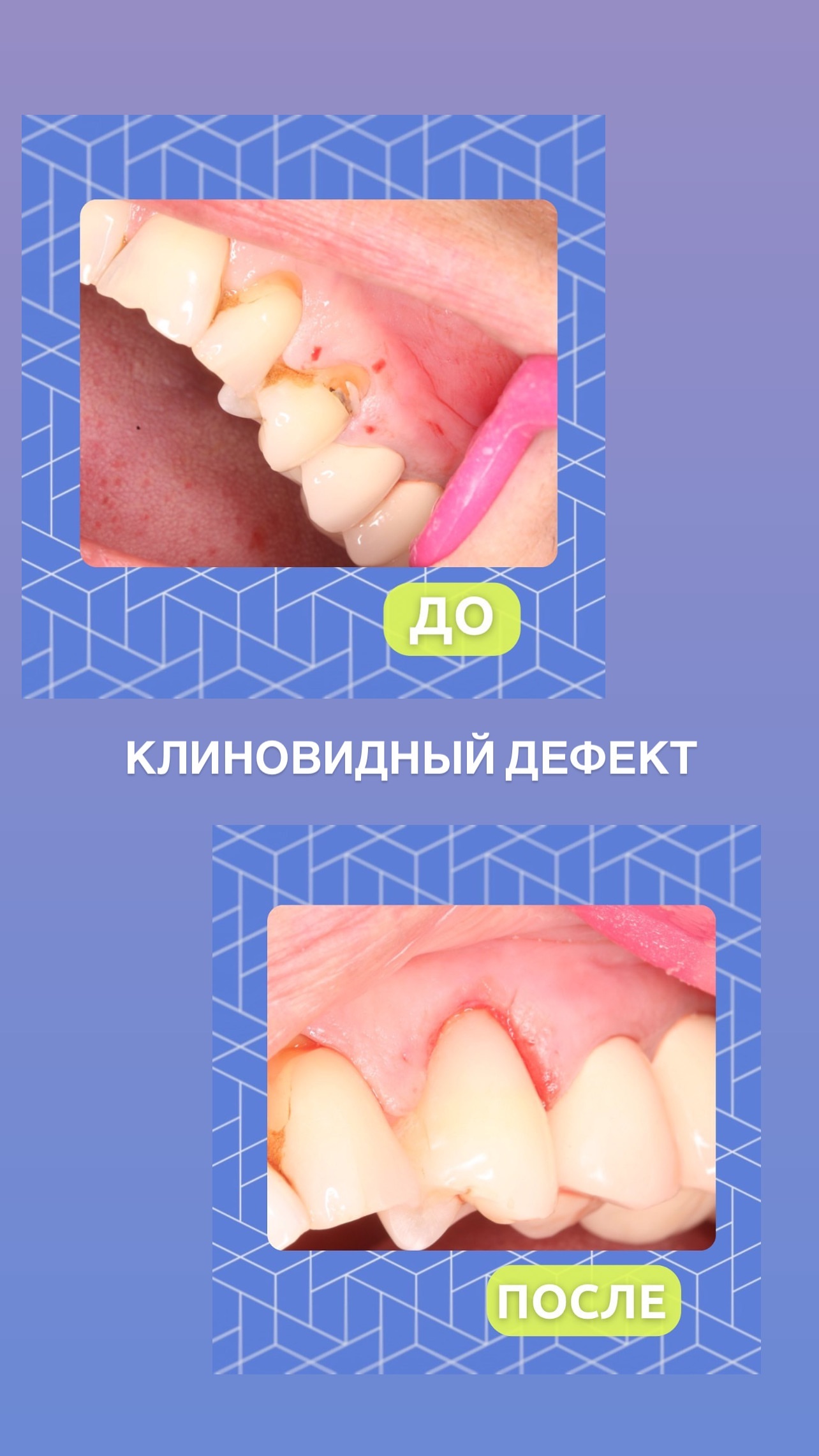 Работа 5